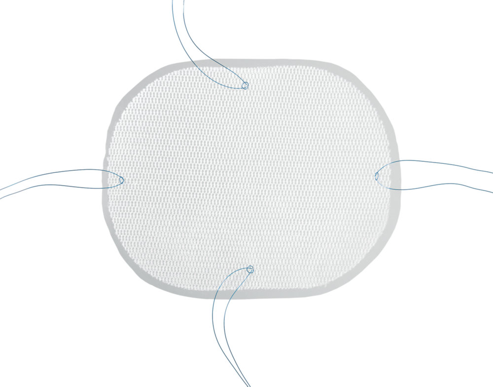 Parietex™ optimized composite mesh